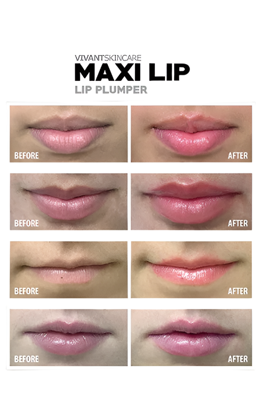 Vivant Maxilip Lip Plumper