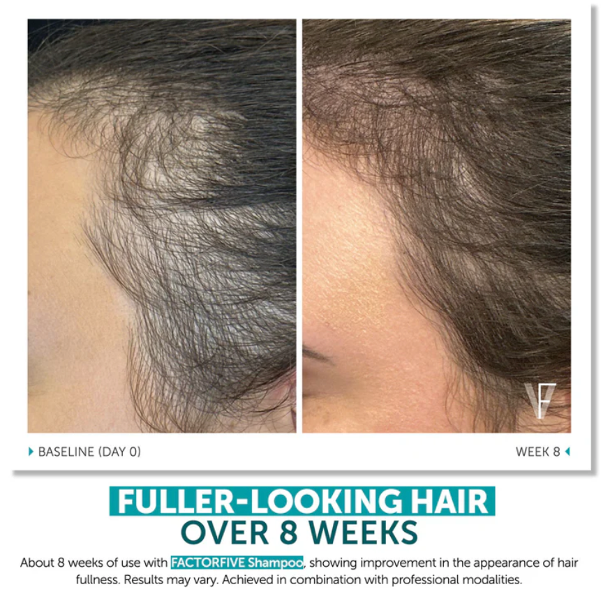 FACTORFIVE Shampoo Advanced Haircare