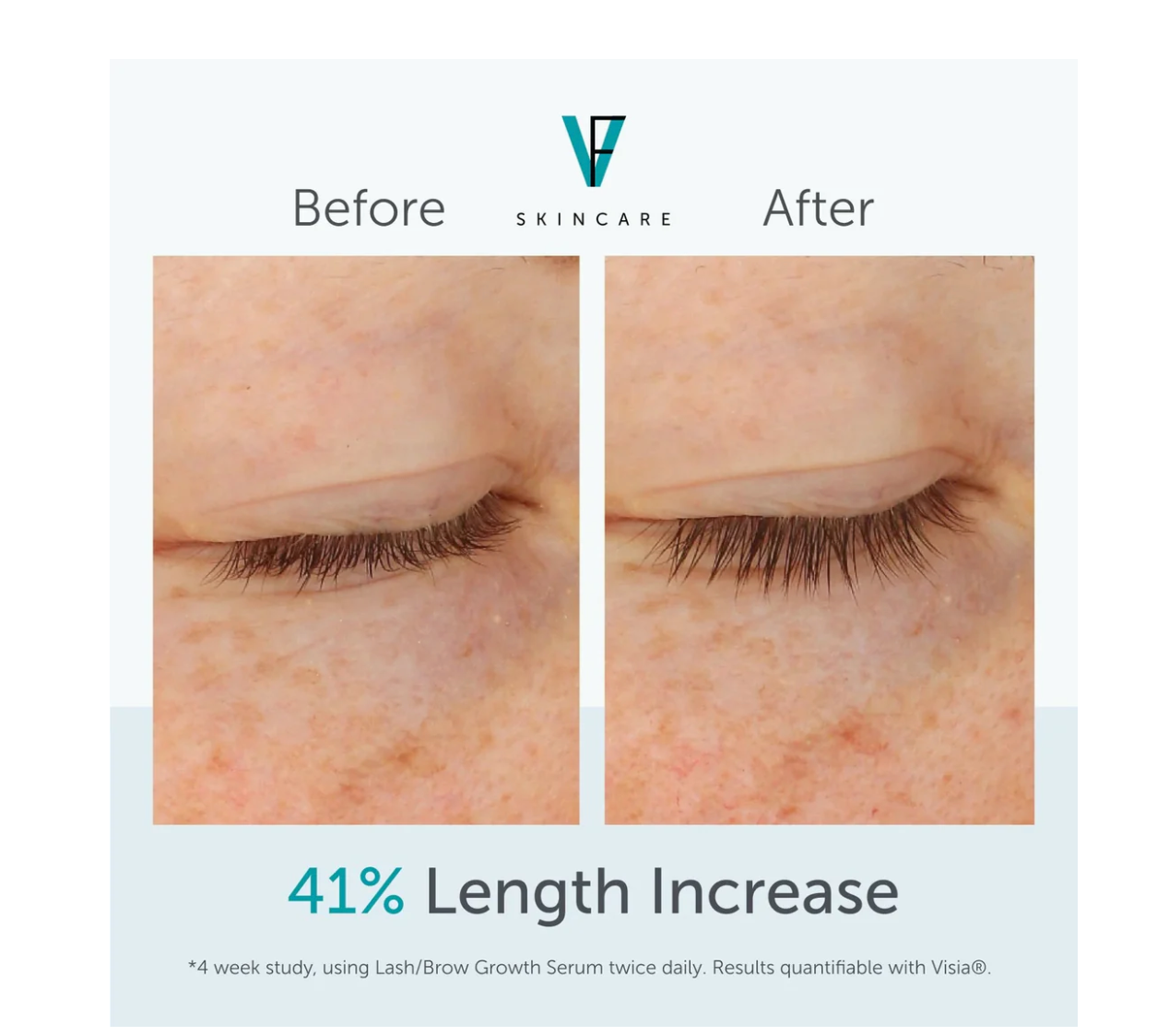 FACTORFIVE Lash/Brow Growth Serum