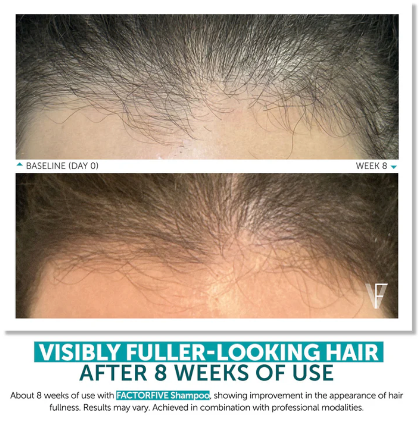 FACTORFIVE Shampoo Advanced Haircare