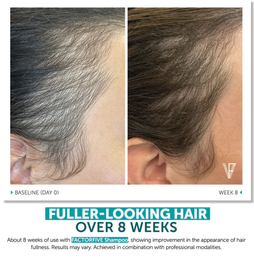 FACTORFIVE Shampoo Advanced Haircare